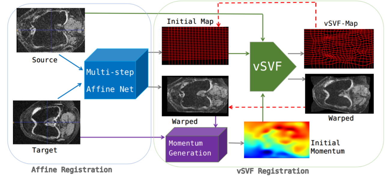 Networks for Joint Affine and Non-parametric Image Registration