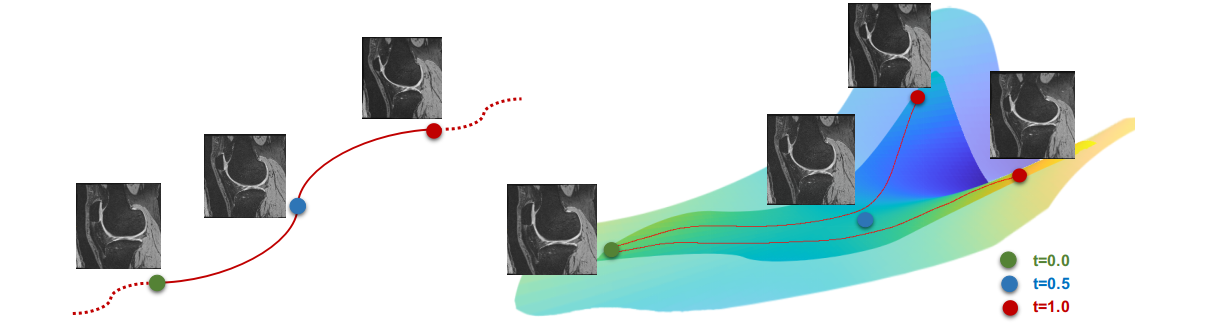 Anatomical Data Augmentation via Fluid-based Image Registration